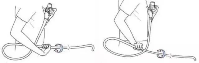 结肠镜检查术教学,结肠镜操作技巧与图解