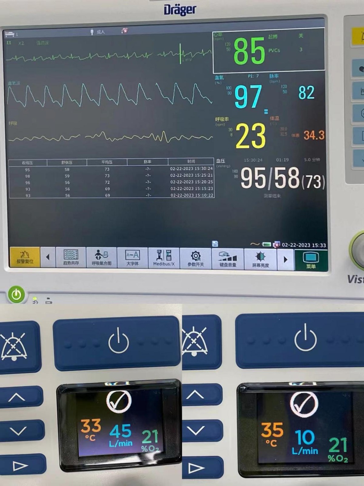 高流量吸氧感受,高流量吸氧技术是什么