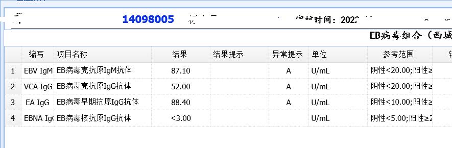 接吻病是真的吗,接吻病你了解多少