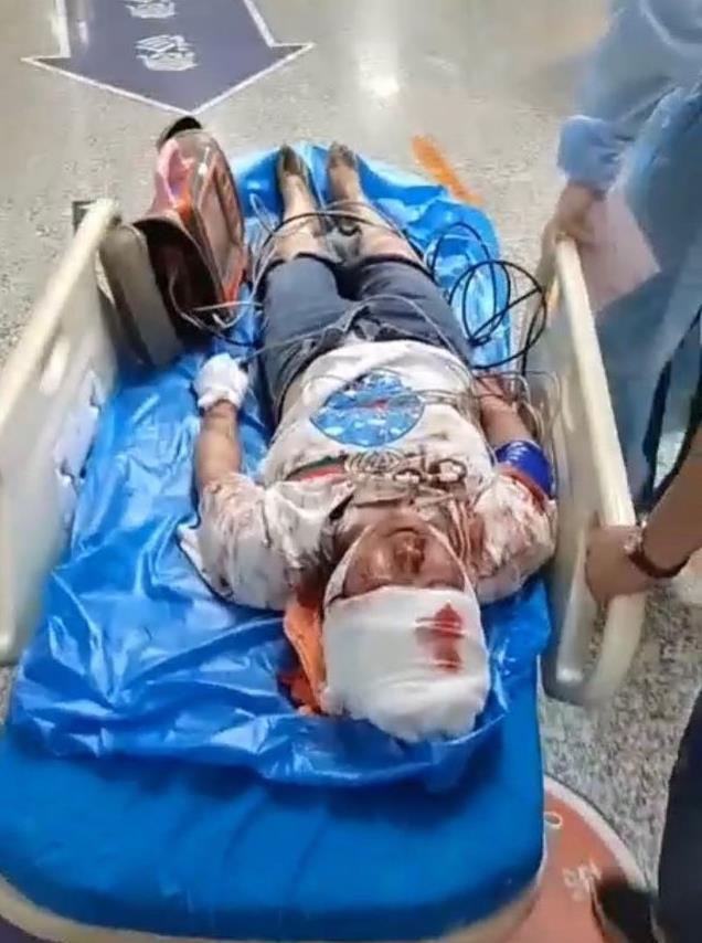 唐山被打女子伤情鉴定出来了吗,唐山被打女生伤情鉴定解说