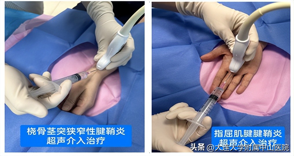 西安肌骨超声精准治疗,门诊超声