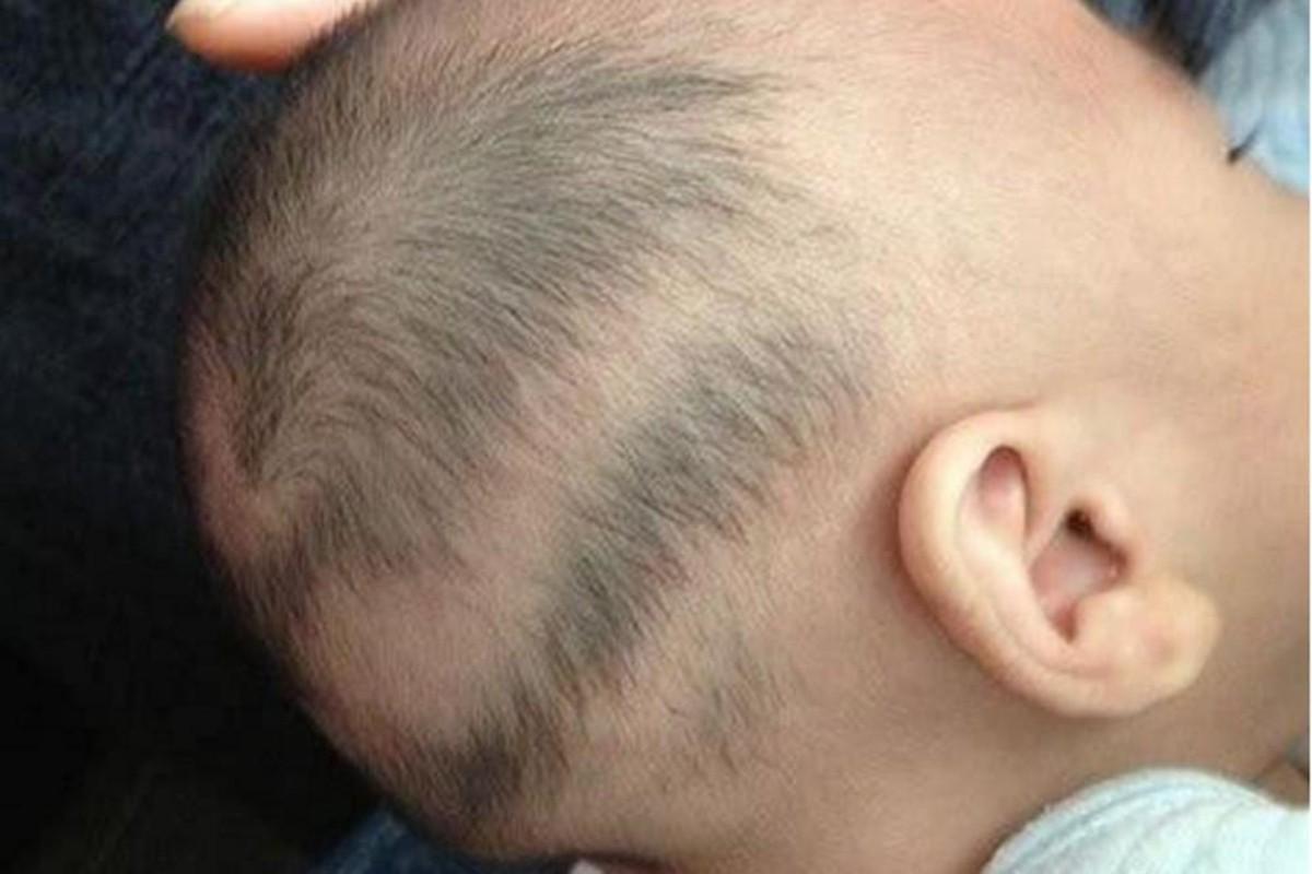 宝宝枕秃就是因为缺钙了是真的吗,宝宝有枕秃就是因为缺钙吗