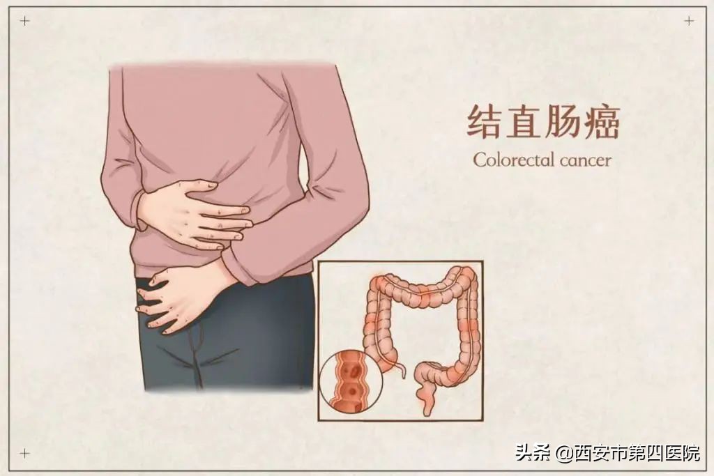 健康科普预防癌症,如何有效的预防癌症遗传