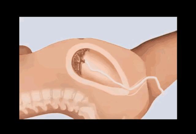 女人生宝宝的科普故事,科普关于女人生孩子