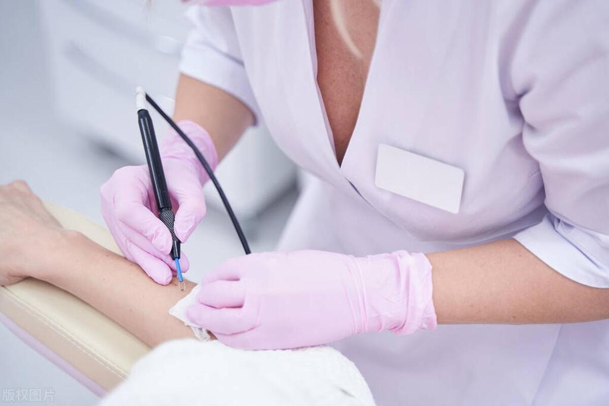 身上长满小肉粒怎么办,身上长出小肉粒可以掐掉吗