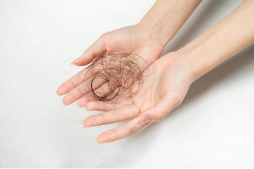 严重脱发有什么方法可以治,脱发怎么治疗才真正有效