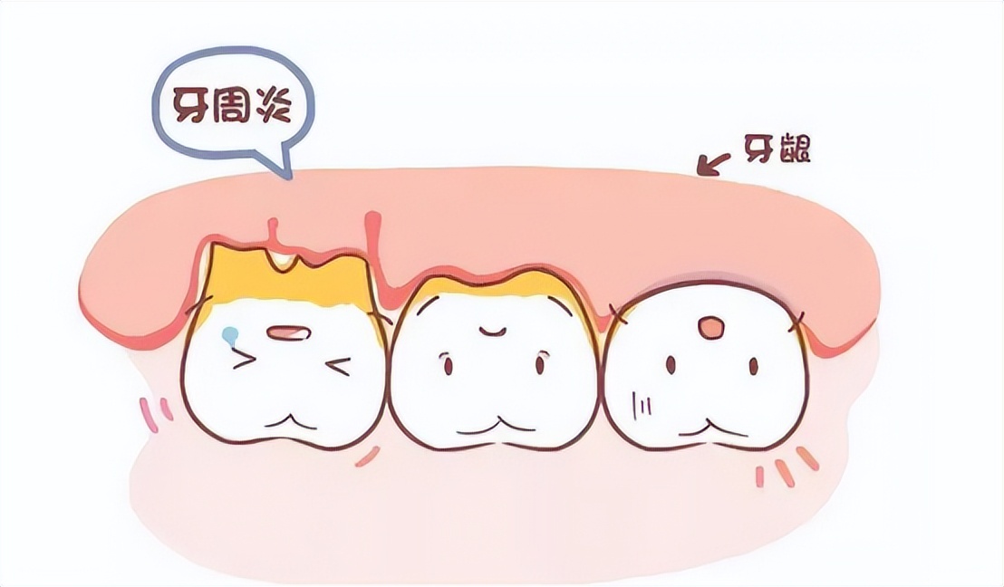 电动牙刷哪个品牌好权威测评,babysmile电动牙刷s202和s204