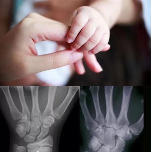 儿童身高长到多少最合适,儿童身高标准表你家娃达标了吗