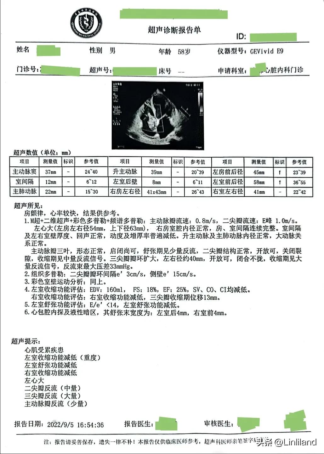 过速性房颤治疗,持续性房颤心动过速