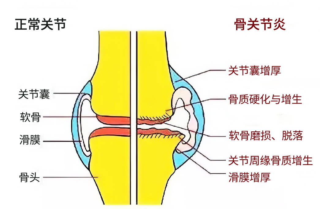 鞋子太紧穿不舒服怎么办,鞋子太松不跟脚