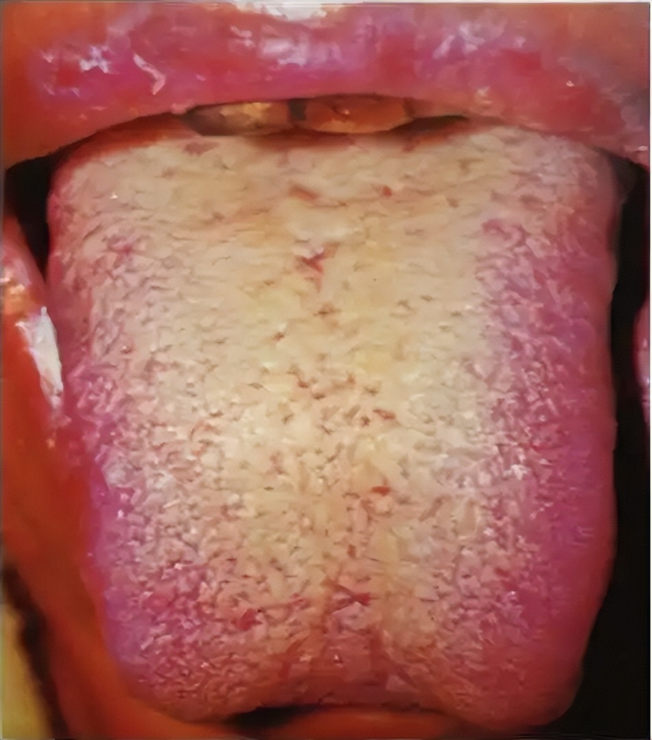 黄连上清片有清热解毒的作用吗,黄连上清片几块和十几块的区别