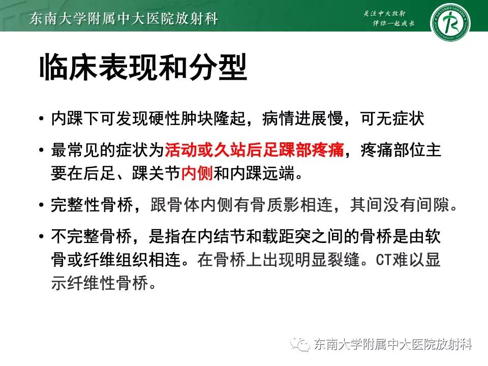 好文分享-《肌骨系统疾病——副舟骨综合征》