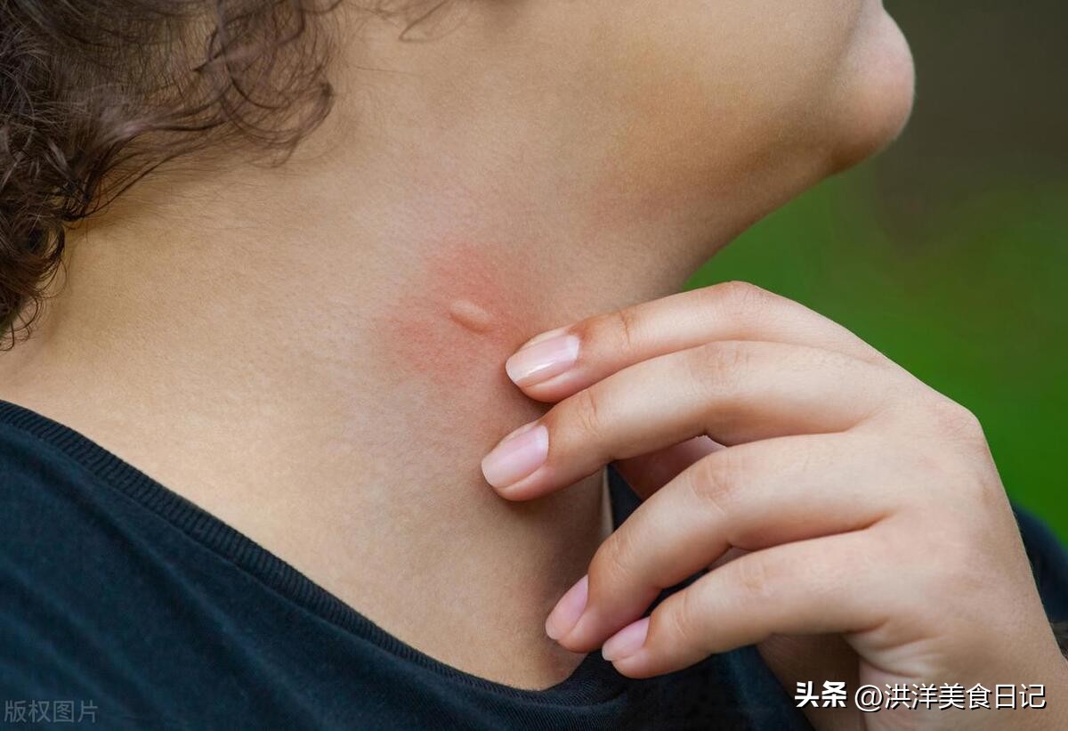 立夏开始有了蚊子,夏季防蚊指南助你和蚊子绝交