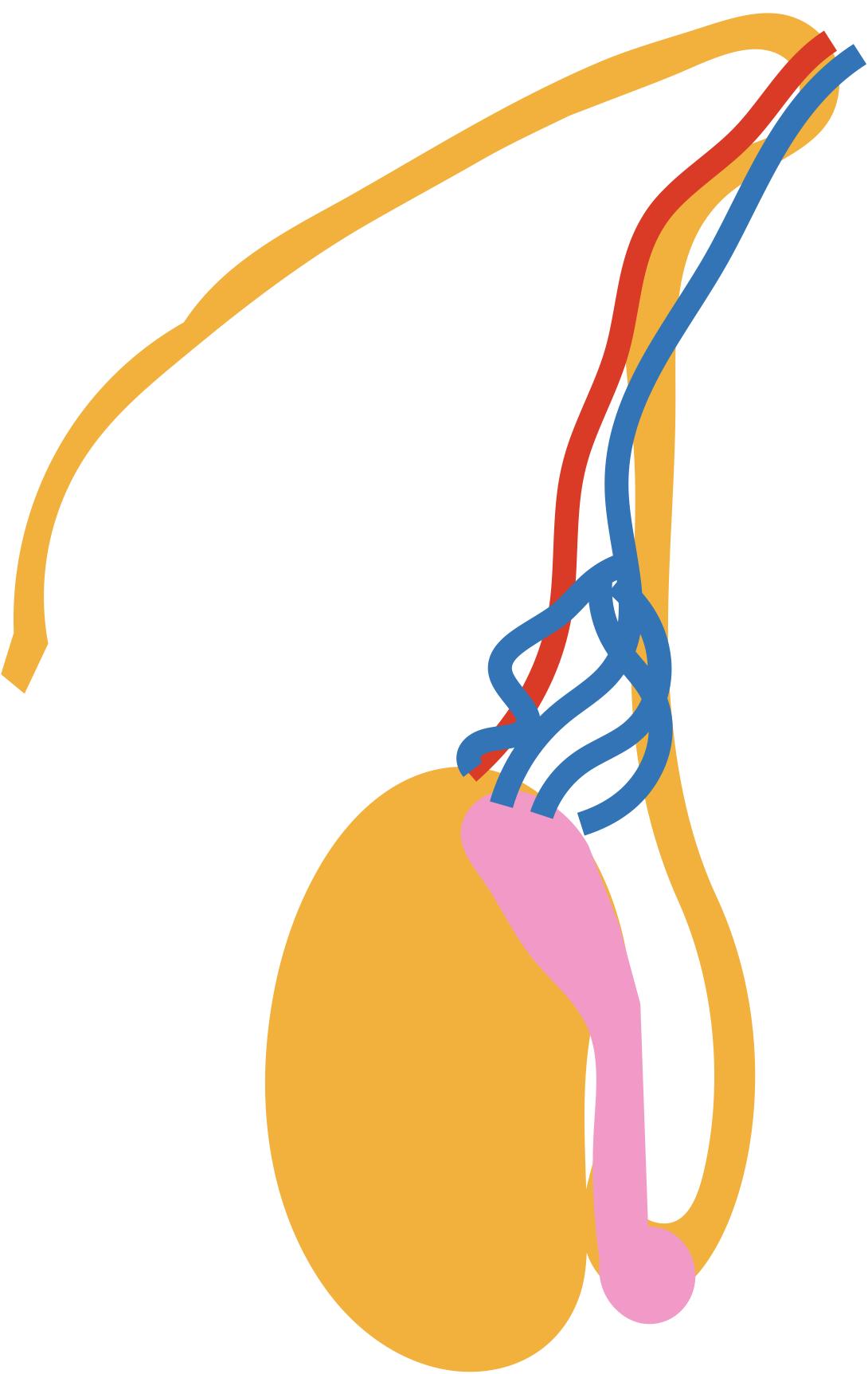 男子*丸睾**疼痛,放射到两边肾脏,医生像盘核桃一般,为其揉搓检查