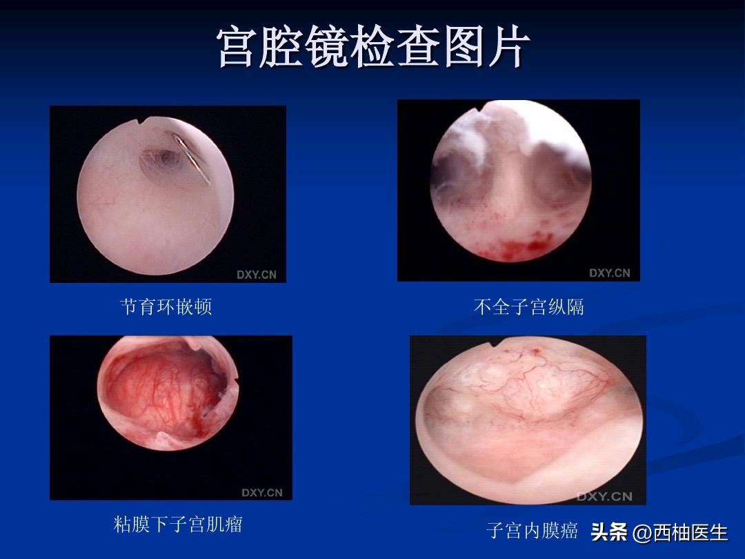 宫腔镜手术前需要做哪些检查项目,做宫腔镜检查需要打麻醉药吗