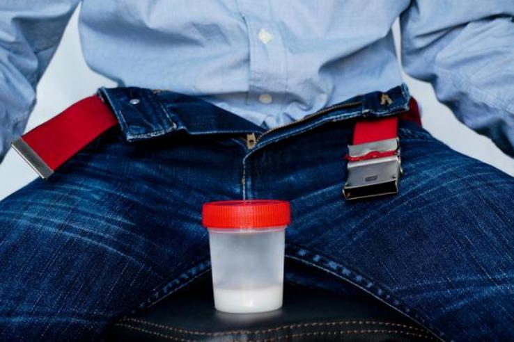 结扎避孕概率,结扎是最好的避孕方法吗