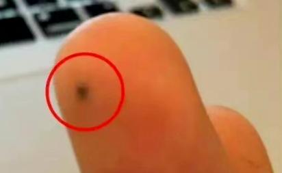 小孩儿手里扎进了铅笔芯怎么办,8岁小孩眼睛不小心被铅笔戳了