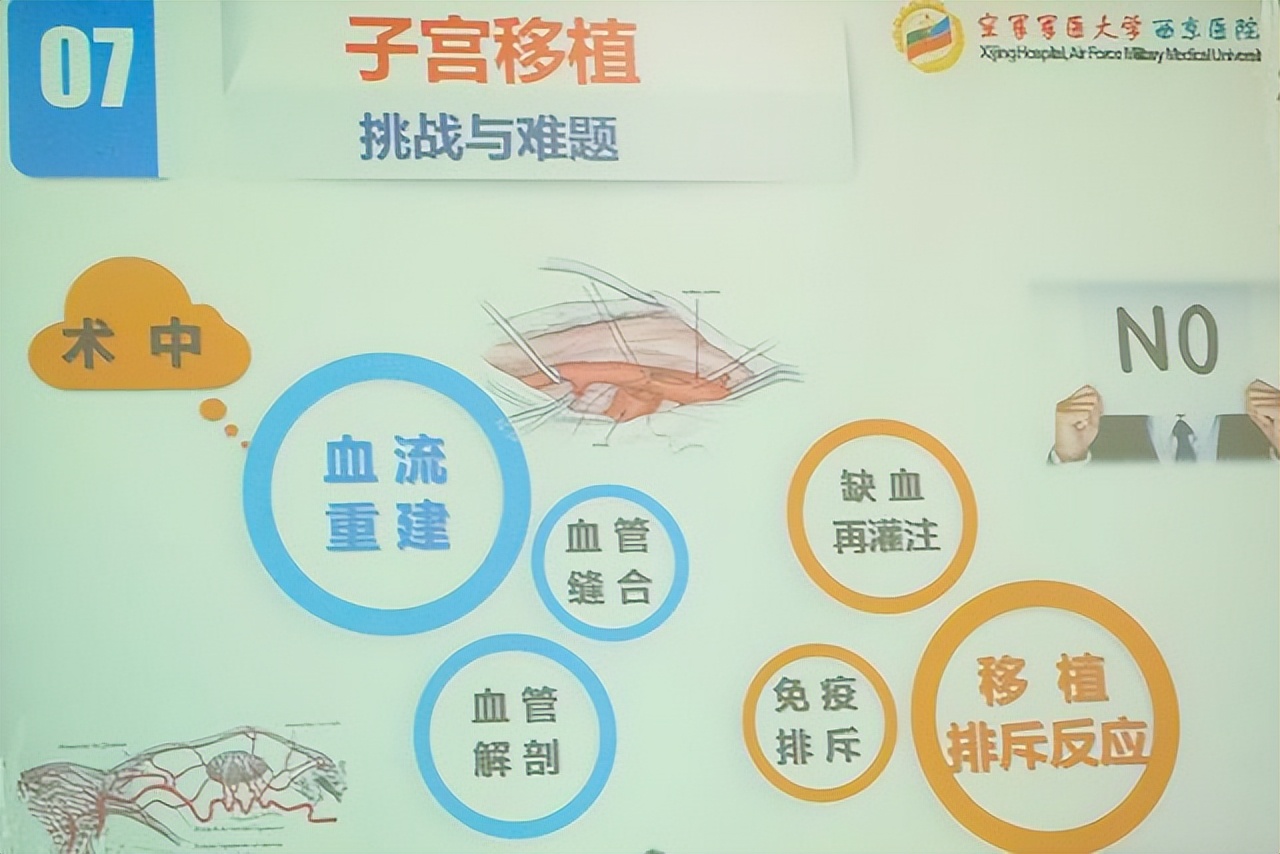 2015年，西安43岁母亲把子宫移植给女儿，4年后，诞下一健康男婴