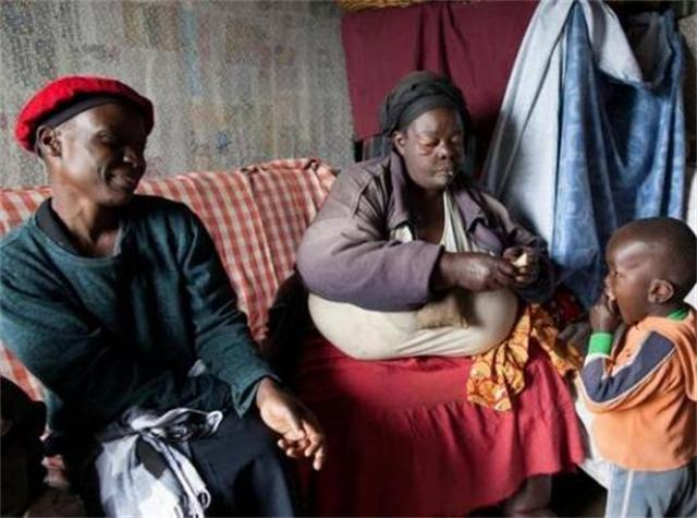 非洲有一体重300斤的“美女苏珊”,2000年,丈夫辞职在家陪妻子