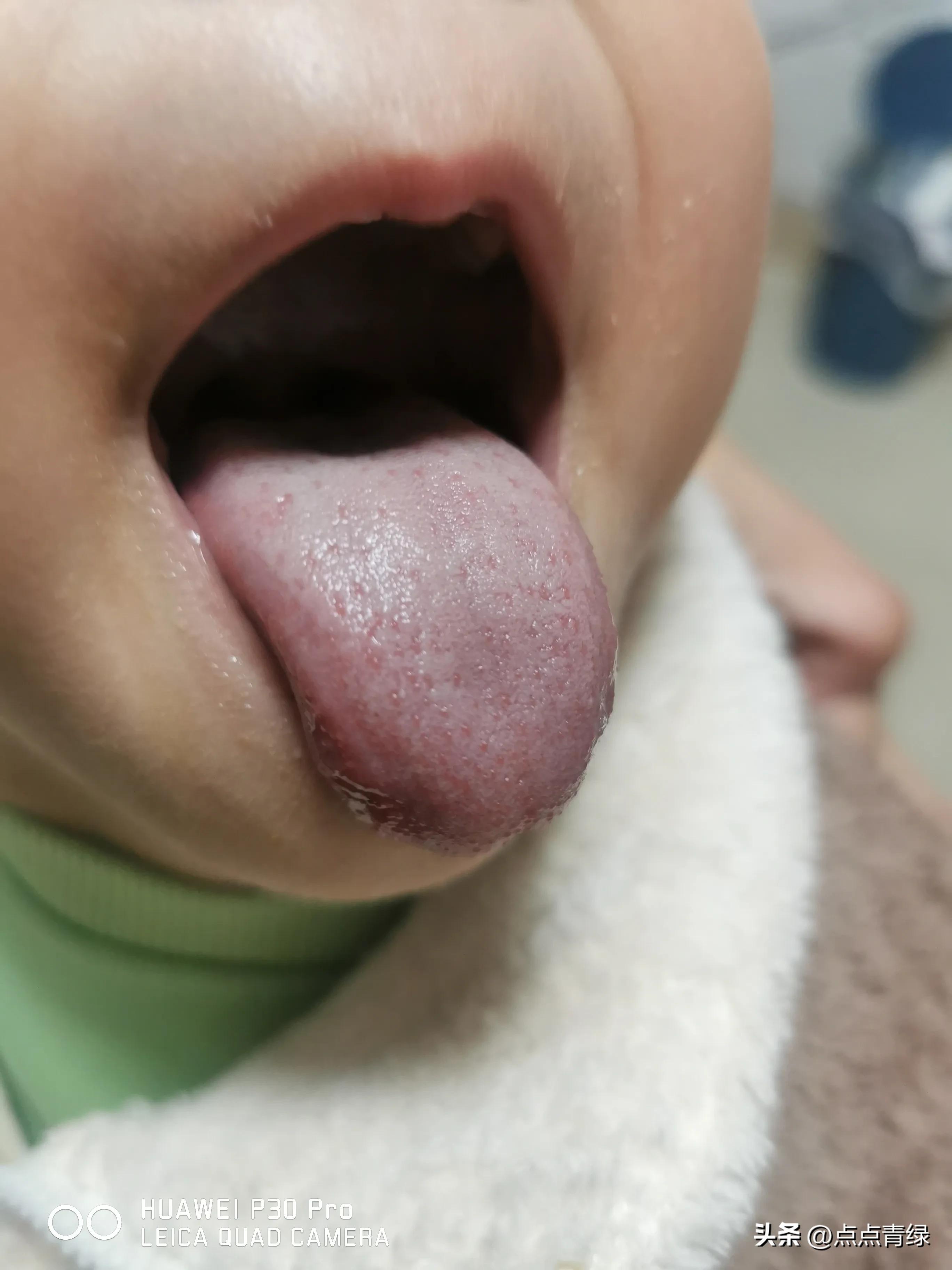 父母同时生病两个孩子照顾,孩子和我妈都生病了我该照顾谁