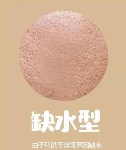 毛孔粗大黑头多脸爱出油怎么解决,解决男士毛孔粗大最简单方法