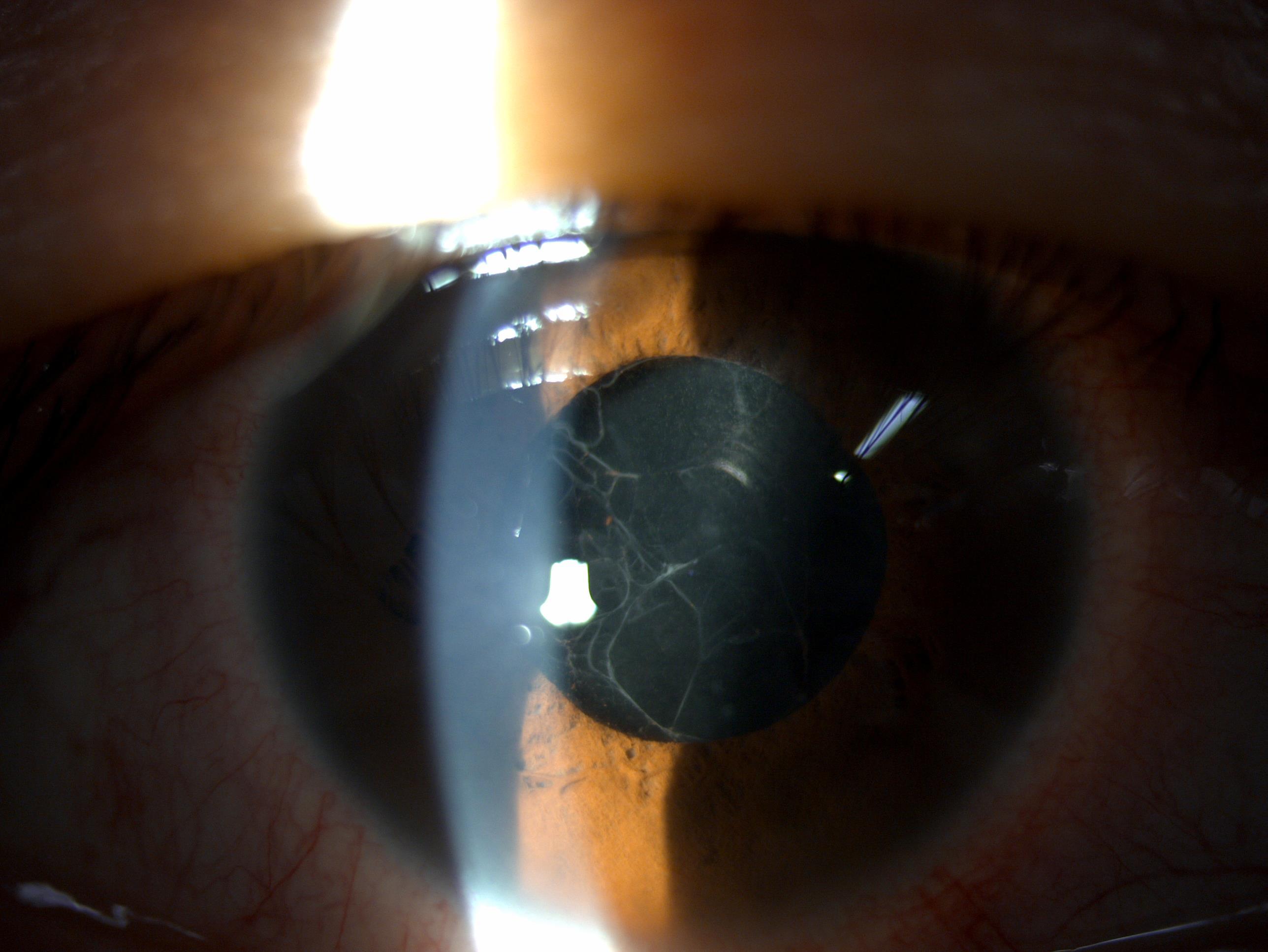 我和来自美国求医的Jason过了一个虚惊一场的父亲节