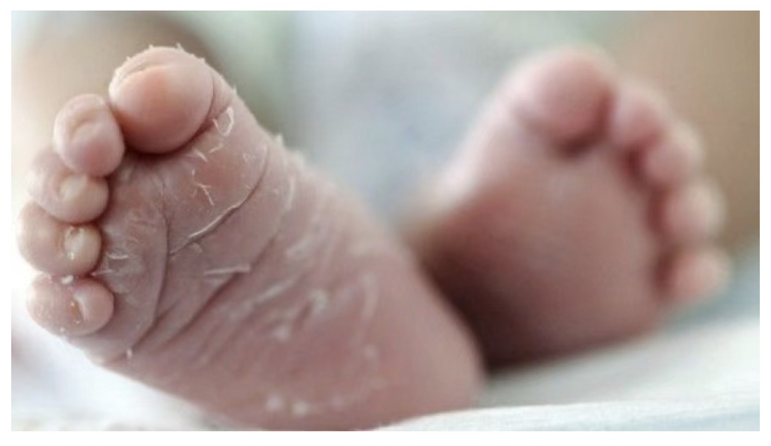 新生儿皮肤脱皮怎么回事？日常护理注意8点，爸妈早知道早放心