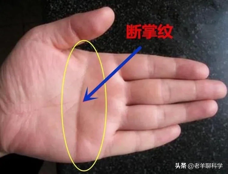 关于断掌纹的民间说法,断掌纹的性格有科学依据吗