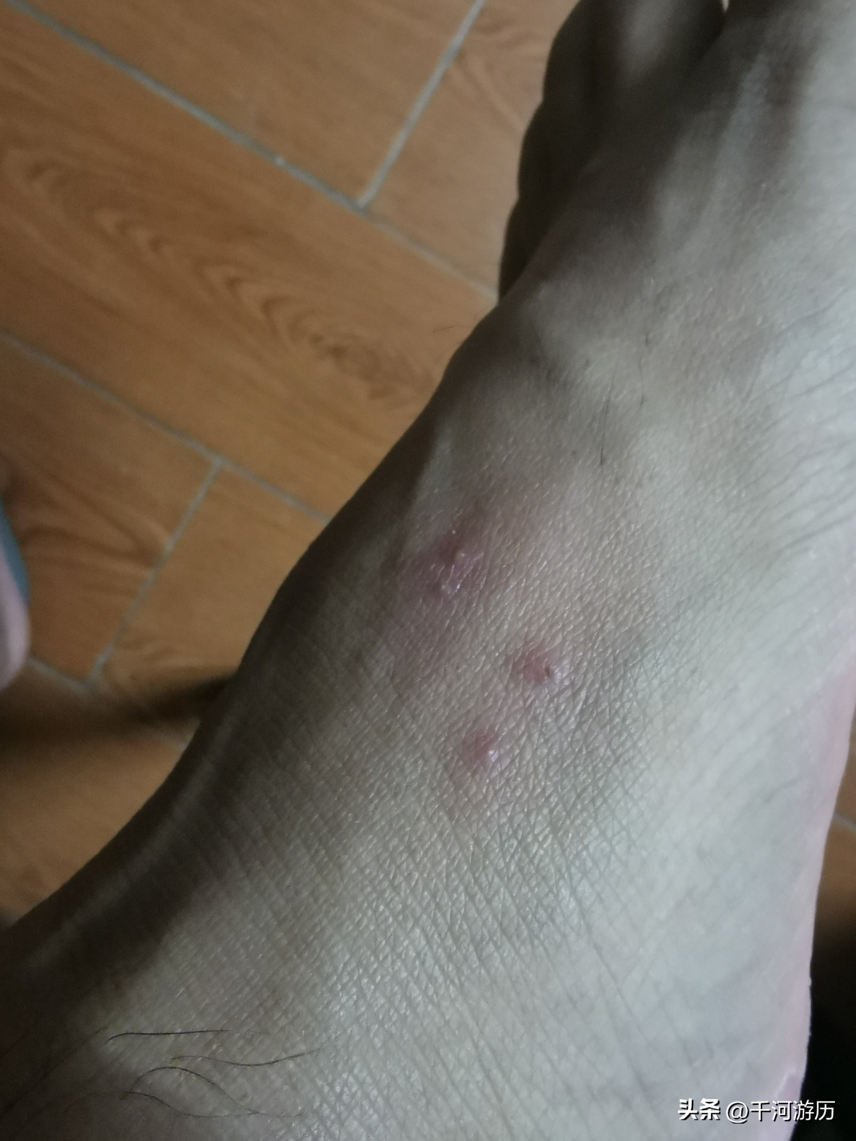 广东红火蚁怎么治,广东发现红火蚁要找哪个部门处理