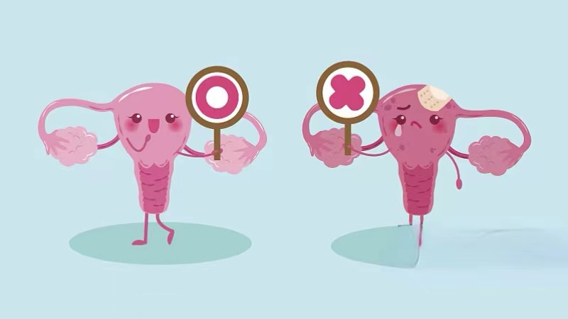 巨阴症是好事吗,巨阴症什么样