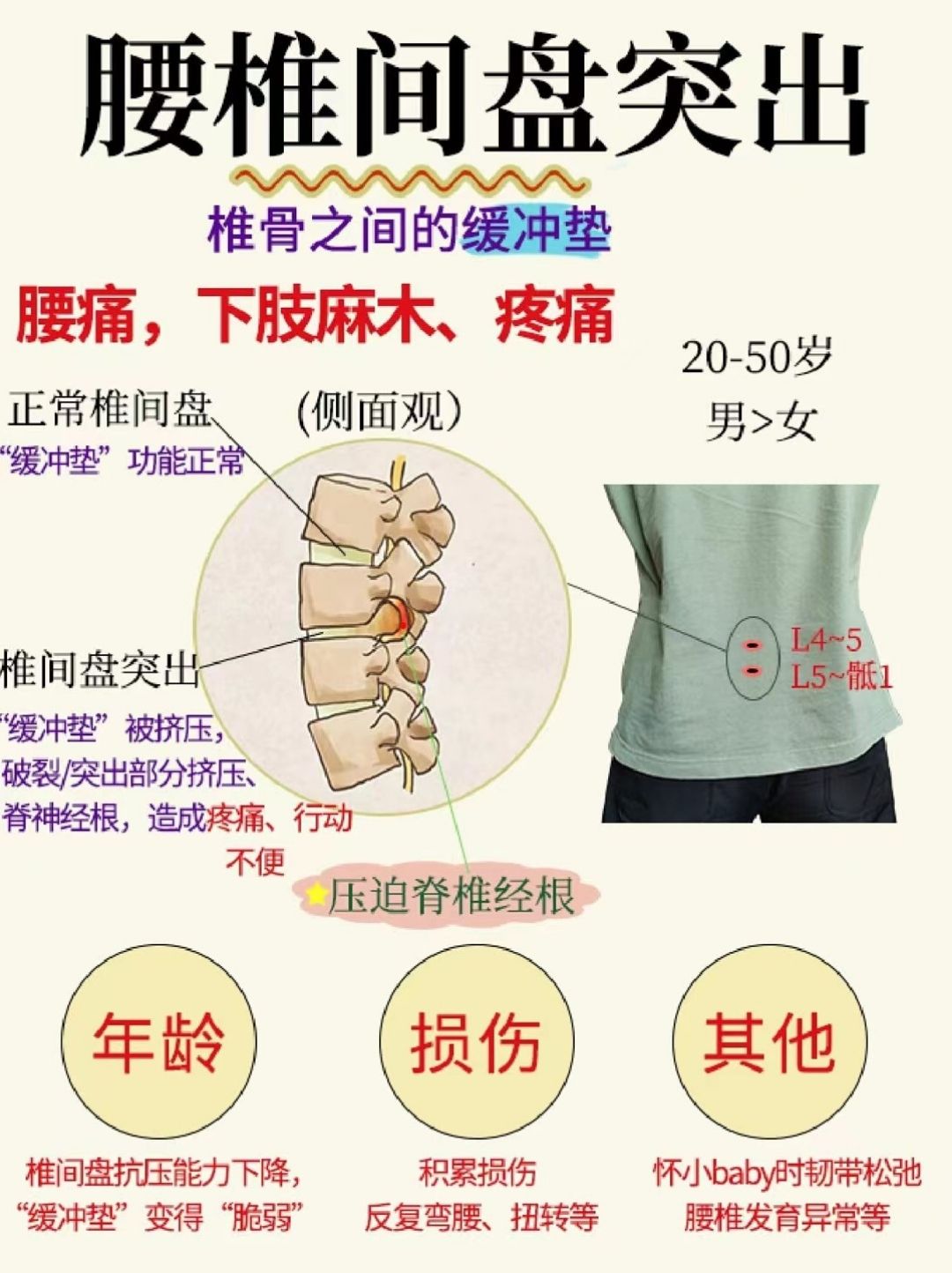 腰肌劳损和腰椎间盘突出鉴别诊断,腰椎间盘突出和腰肌劳损怎么治疗