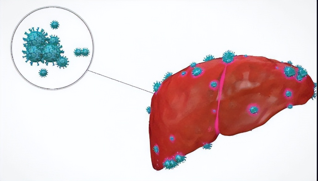 乙肝服用艾米替诺福韦片寿命,乙肝第一次治疗吃艾米替诺福韦