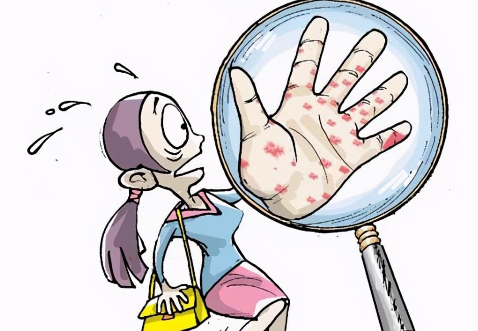 梅毒感染期如何避免感染,梅毒传染性高不高