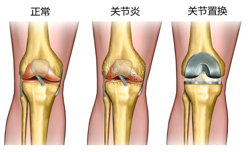 做手术的过程从进手术室开始,从做检查到手术整个流程