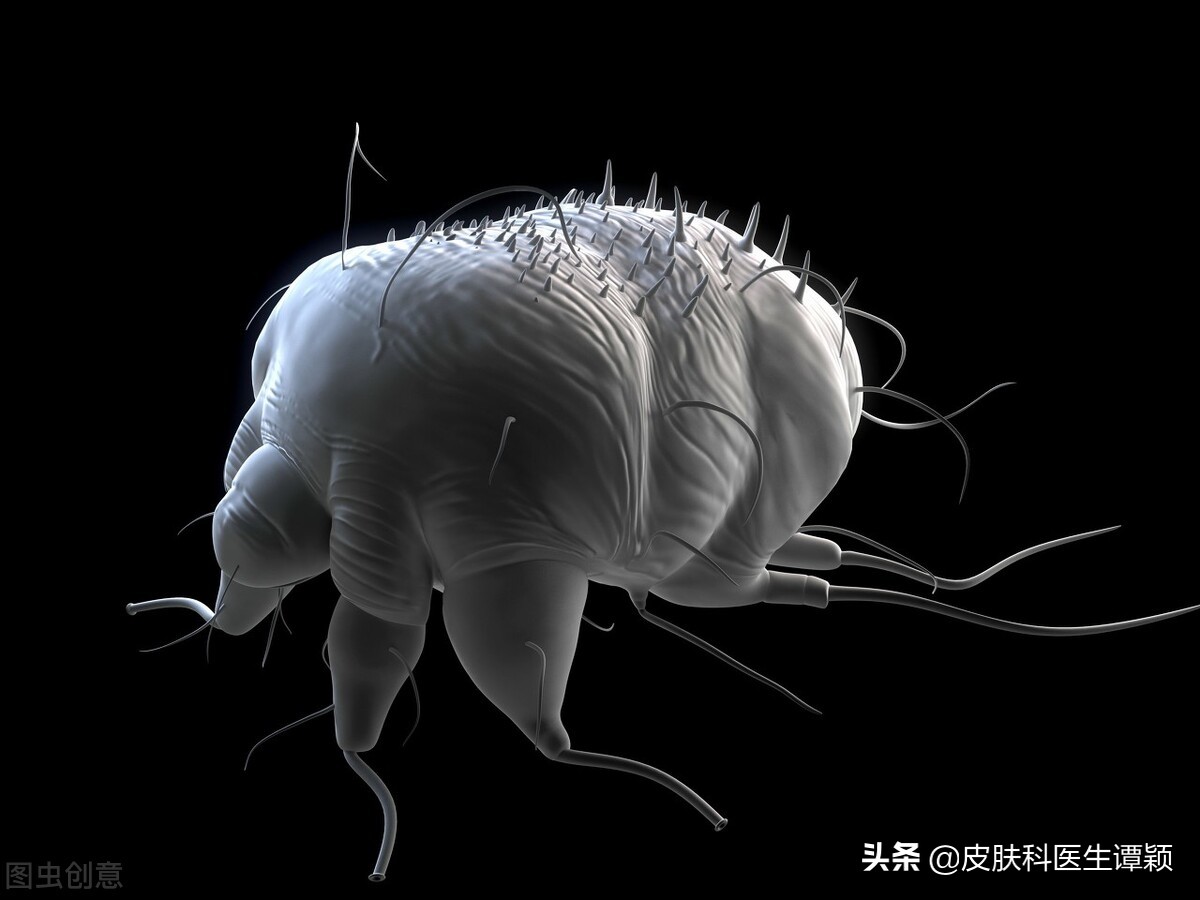 皮肤科疥疮的正确治疗,皮肤科医生怎么样确诊疥疮