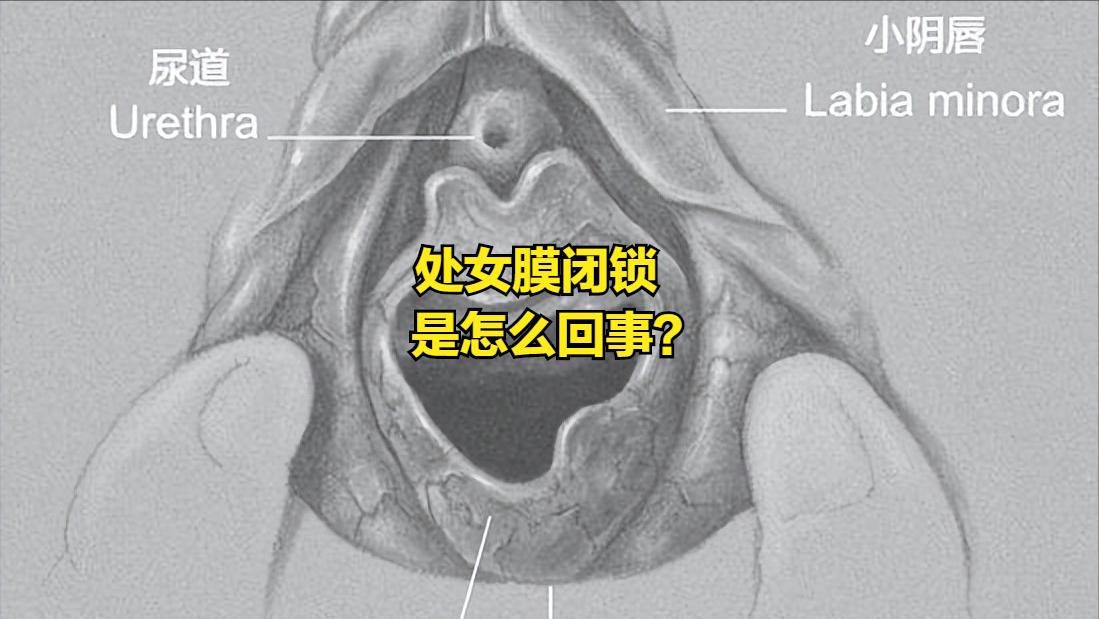我女儿17岁月经有一年多没来了,女儿今年13岁了没来过月经