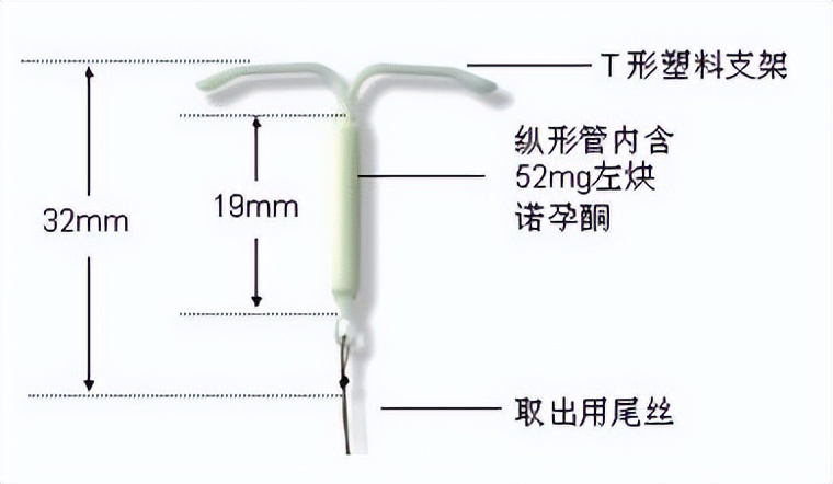 经期流血疼痛,经期出血量大还疼咋回事