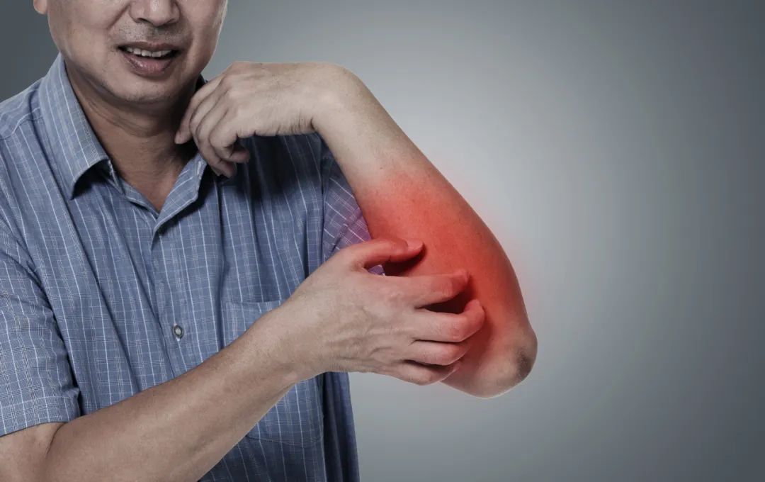 张仲景治疗湿疹反复发作的方子,宝宝湿疹反复发作的原因是什么