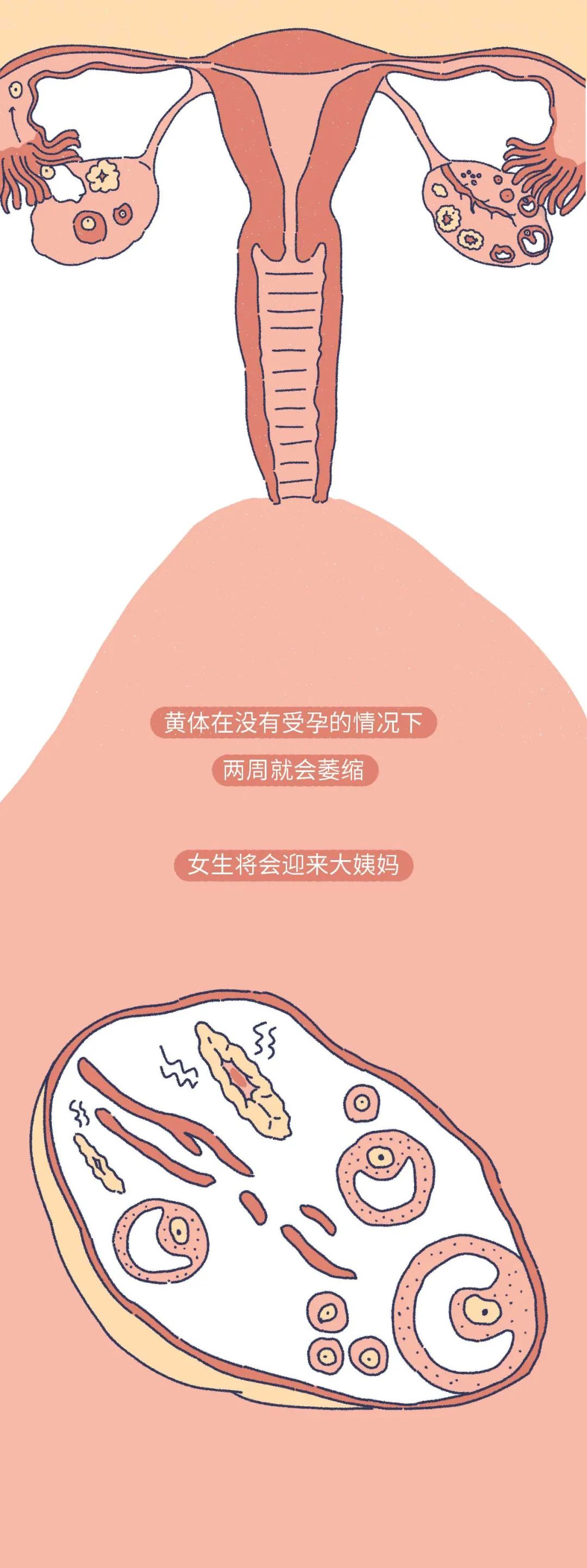 女生黄体破裂会是什么表现,什么原因会导致女性黄体破裂