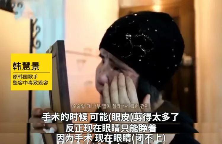 韩慧景整容是打了玻尿酸了吗,2004年整容狂魔韩慧景的故事