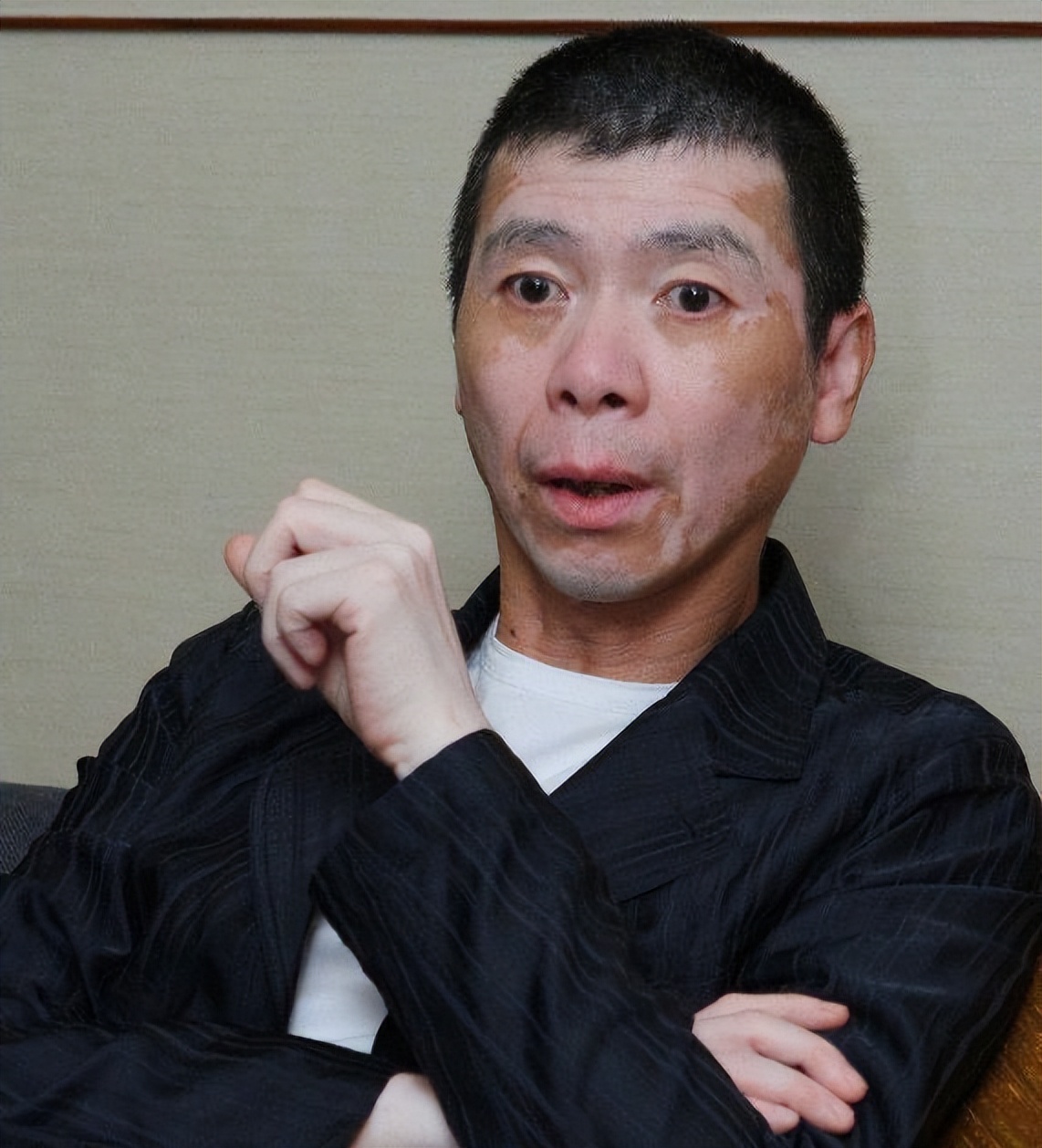 冯小刚近照曝光白癜风明显,冯小刚图片白癜风
