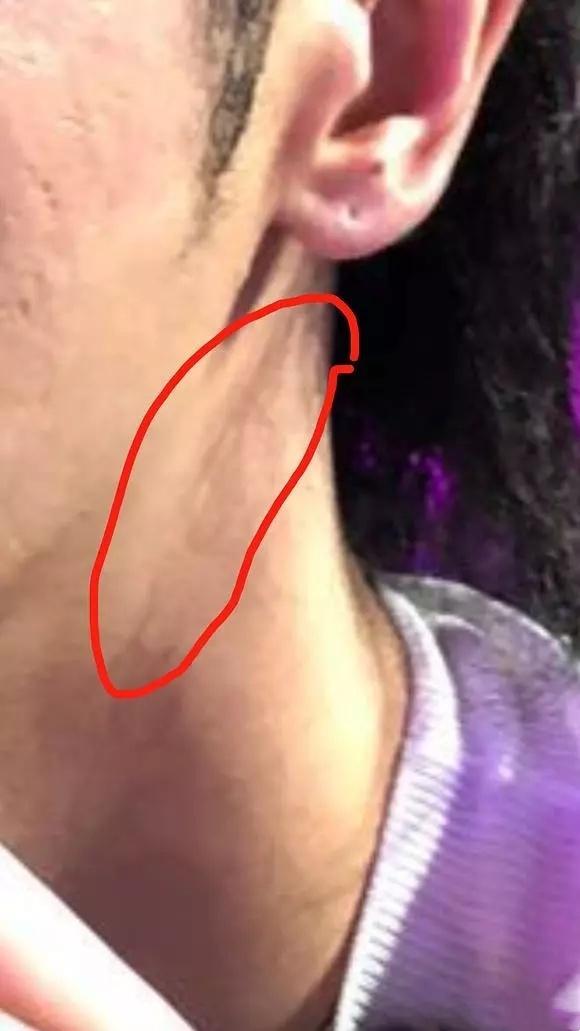 华晨宇下颌骨角度,华晨宇削下颌骨了吗