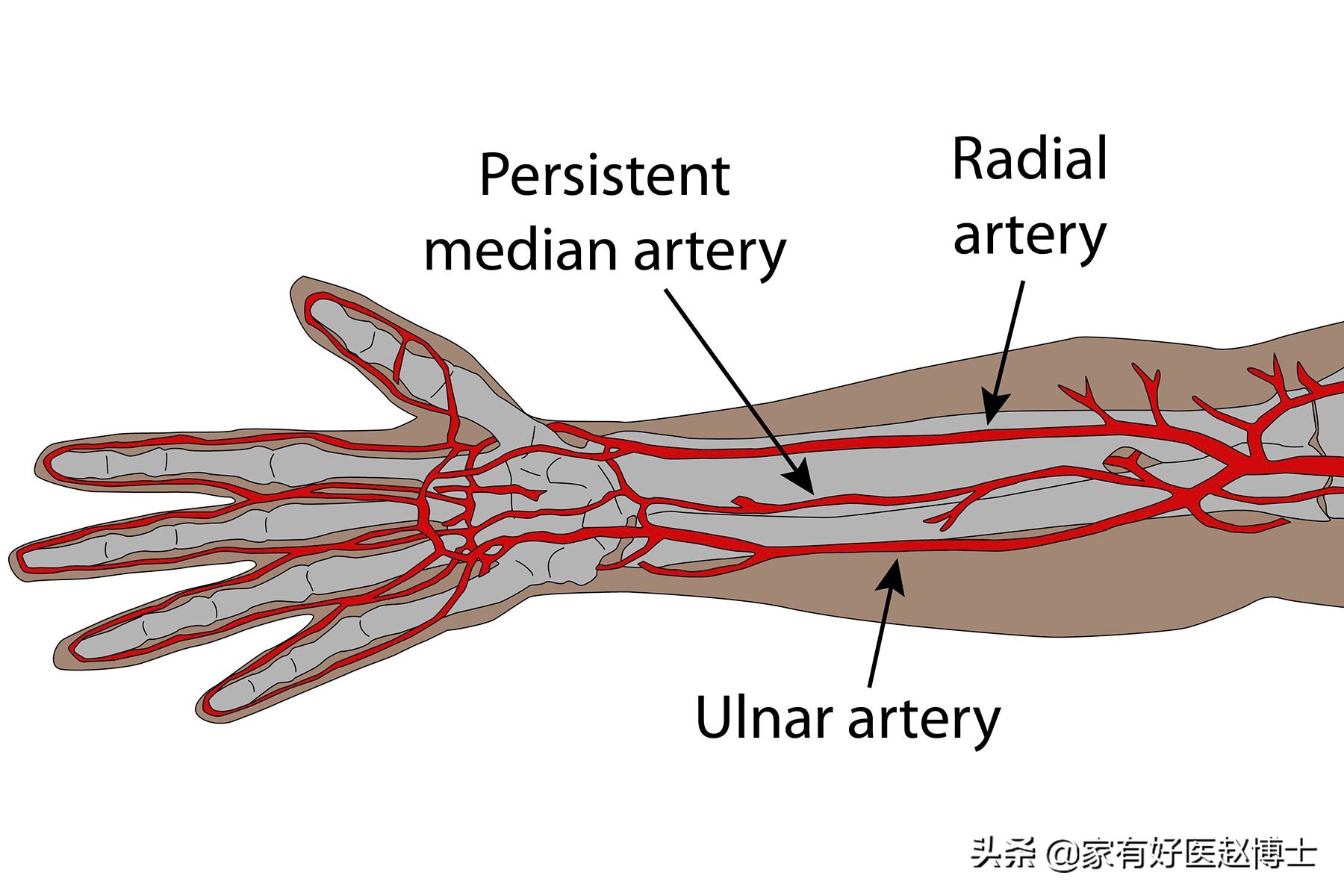动脉弹性轻度下降怎么办,动脉硬化后动脉弹性下降