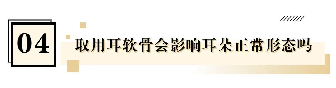 韦敏隆鼻鼻翼缩小,上海韦敏隆鼻案例