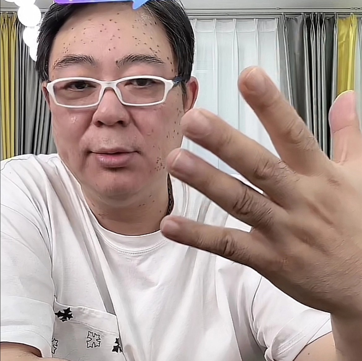 高亚麟是不是得了什么怪病,高亚麟扁平疣怎么祛除的