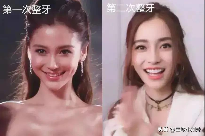 蔡徐坤前东家晒整形费用，整容花了70多万，做头发花了80多万