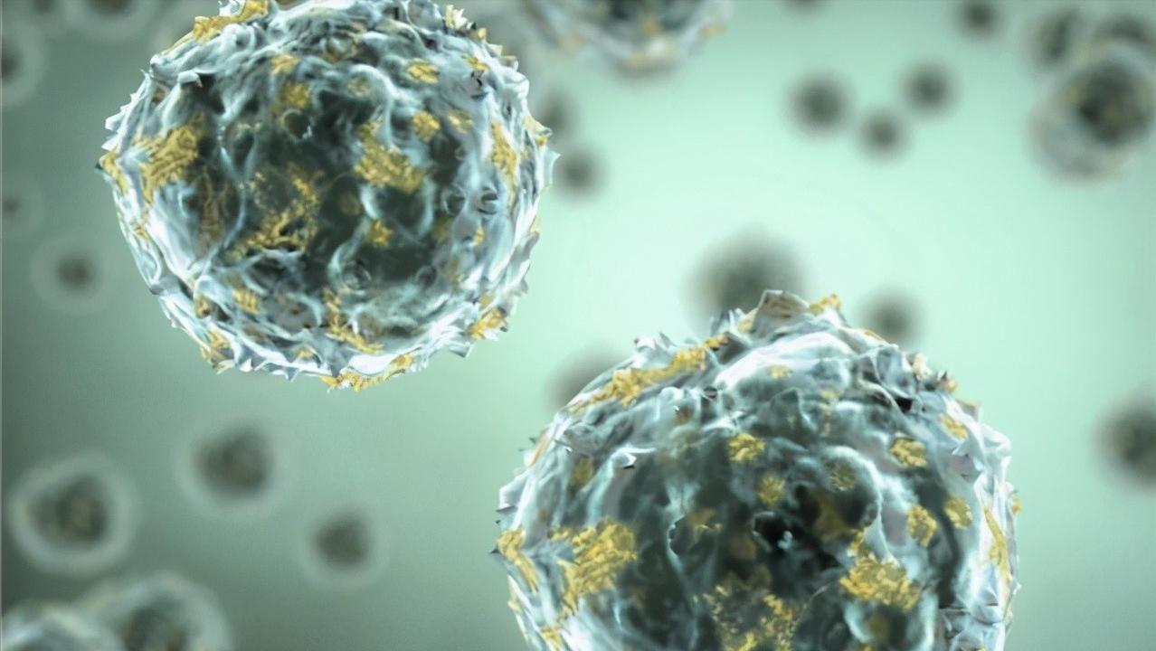 体检发现肝脏有囊肿怎么办,肝上有囊肿要看肿瘤科吗