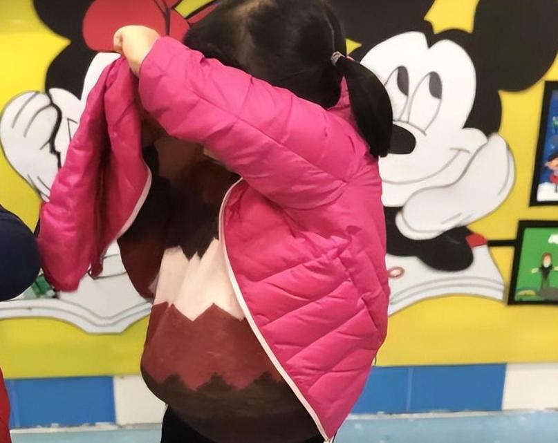 女生变男生手术成功案例,女生变男生手术能做到什么程度