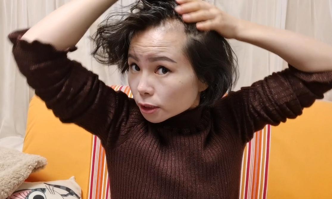 为什么越来越多的年轻人长白头发,年轻人长白发的原因及治疗方法