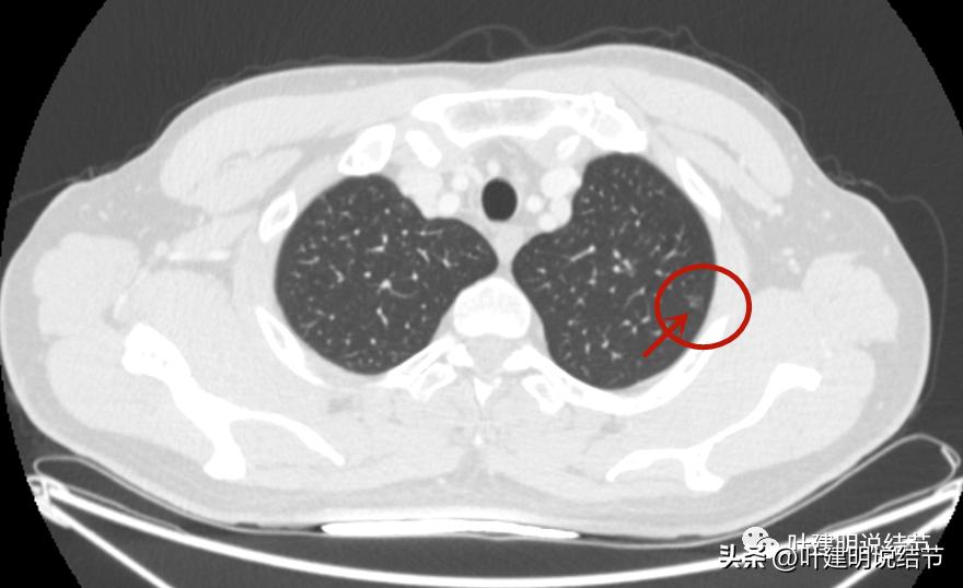 医生为了预防医患矛盾过度诊疗,医院过度医疗手术